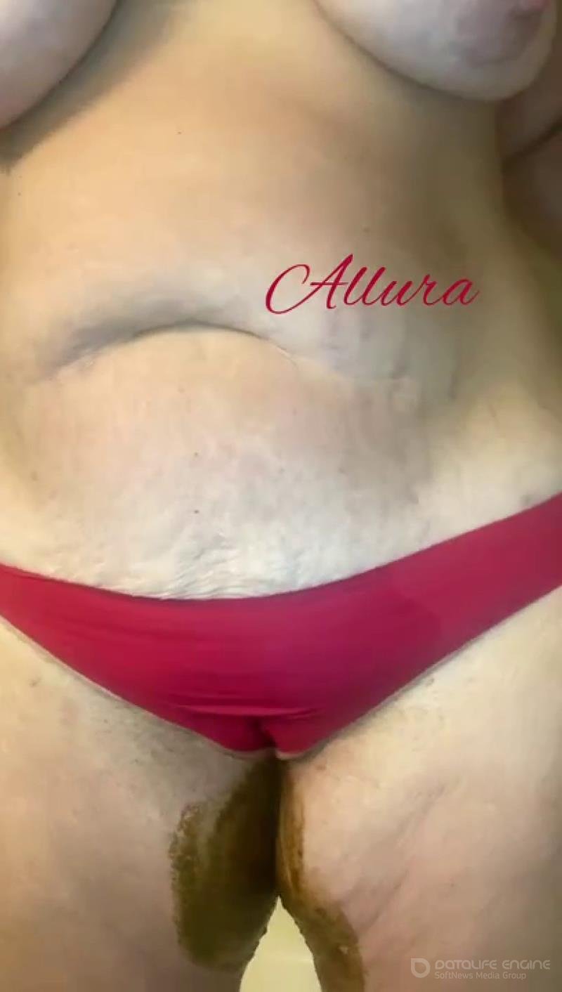 Allura – Camel toe after shitting myself [SD]